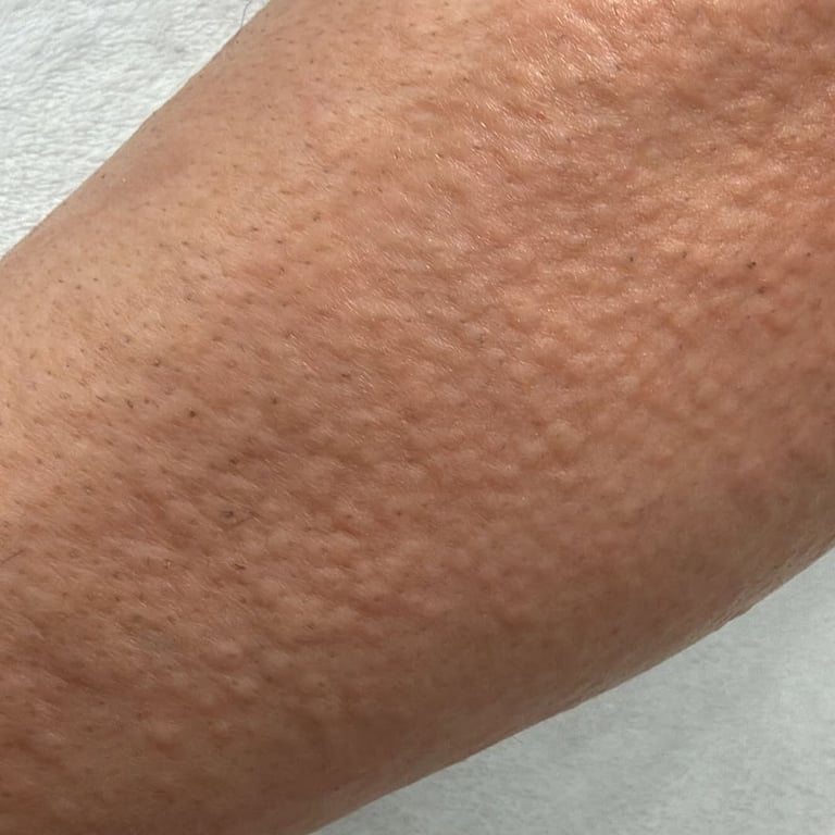 ⁨ تعليمات مهمه خلال جلسات الليزر :- قبل جلسة الليزر:- • يجب توقيف لكريمات الفعاله قبل 5 اي