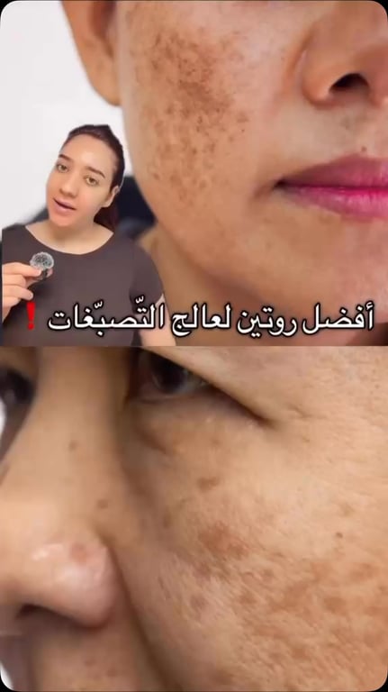 منشور من حجابي رهط