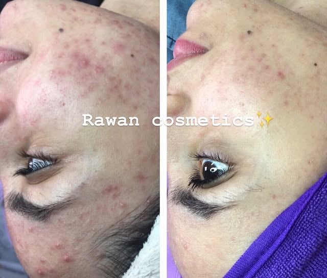 Photo by Rawan Hbaieb on April 28, 2020.